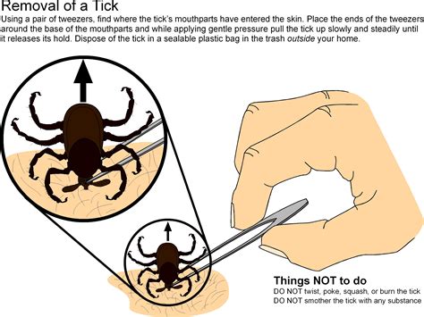 When bitten by a tick, contact the doctor if there is difficulty removing the tick, a rash appears at the bite site, flu-like symptoms develop or the bite site becomes infected, st...